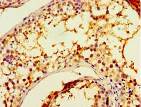 CHRFAM7A Antibody (aa1-150)
