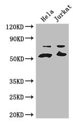YES1 / c-Yes Antibody