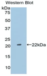 FGF2 / Basic FGF Antibody (aa143-288)