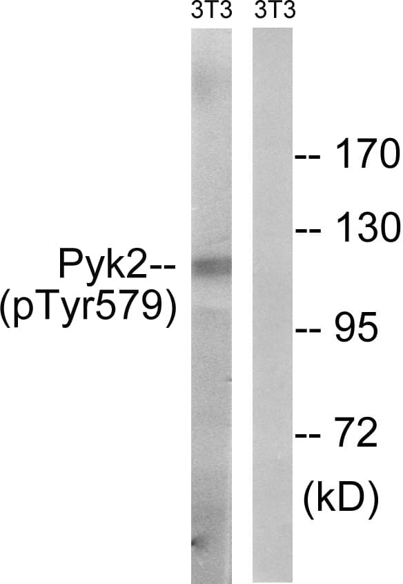 PTK2B / PYK2 Antibody (phospho-Tyr579)