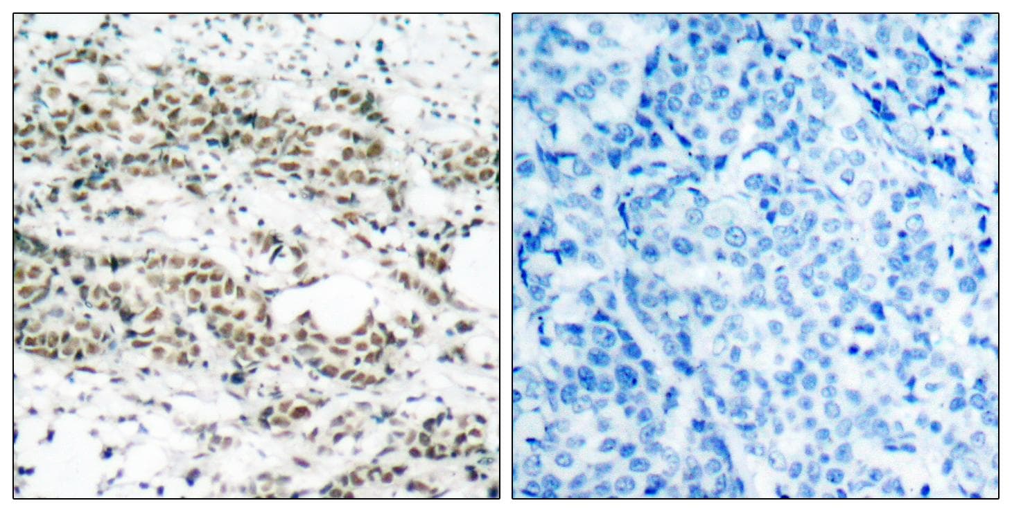 Polyclonal Rabbit anti-Human FOXO4 / AFX1 Antibody (phospho-Ser197, IHC, WB)