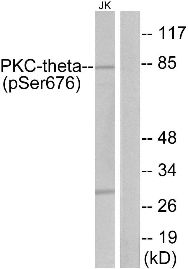 PRKCQ / PKC-Theta Antibody (phospho-Ser676)