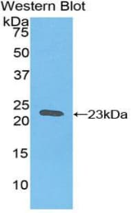 FTH1 / Ferritin Heavy Chain Antibody (aa1-181)