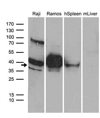 CD79B / CD79 Beta Antibody (clone OTI2B6)