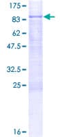 Human METAP2 Protein (Recombinant GST)