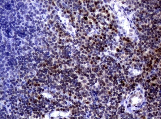 MGMT Antibody (clone UMAB56)