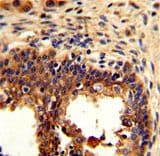 Polyclonal Rabbit anti-Human KRT4 / CK4 / Cytokeratin 4 Antibody (aa386-415, IHC, WB)