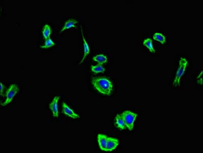 CNR2 / CB2 Antibody