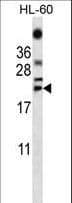 Polyclonal Rabbit anti-Human TNF Alpha Antibody (aa187-216, WB)