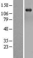 TBC1 / TBC1D1 Protein (Over-Expression Lysate Myc-DDK (Flag))