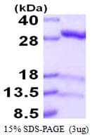 Human IDI1 / IPP1 Protein (Recombinant His)