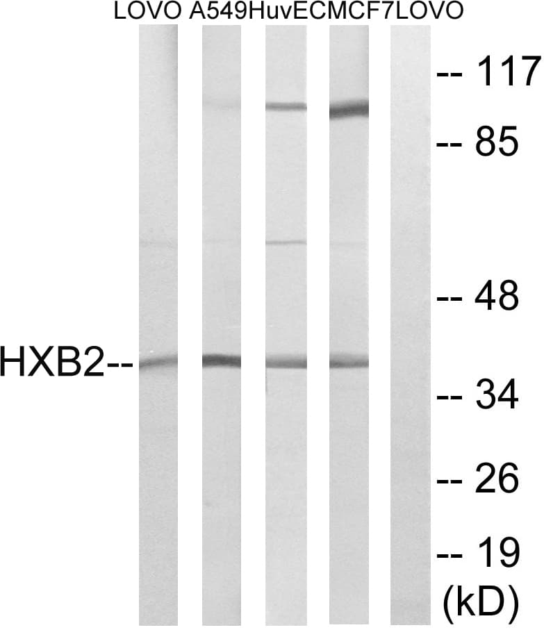 Polyclonal Rabbit anti-Human HOXB2 Antibody (aa41-90, WB)