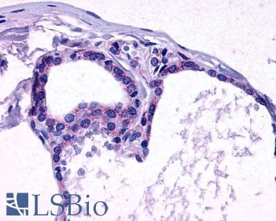 PathPlus™ TSH Receptor / TSHR Antibody (N-Terminus)