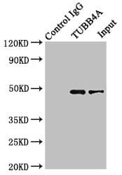 TUBB4 / Tubulin Beta 4 Antibody
