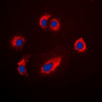 IGF2R / CD222 Antibody (C-Terminus)