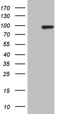 Monoclonal Mouse anti-Human C-TAK1 / MARK3 Antibody (clone OTI2D9, aa473-729, IHC, WB)