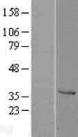 CTSZ / Cathepsin Z Protein (Over-Expression Lysate Myc-DDK (Flag))