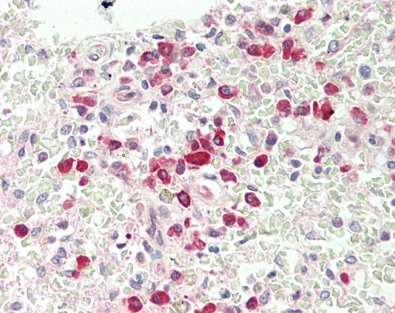 Polyclonal Rabbit anti-Human IL1R1 Antibody (aa488-537, IHC, WB)
