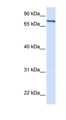 Polyclonal Rabbit anti-Human ZNF180 Antibody (aa288-337, WB)