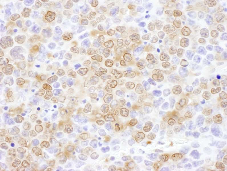 NUDC Antibody (aa281-331)