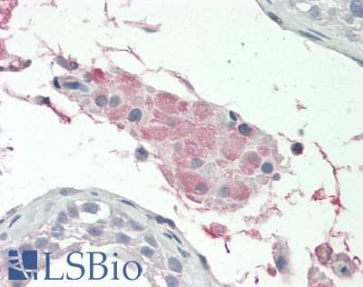 IHC-plus™ Polyclonal Rabbit anti-Human GC / Vitamin D-Binding Protein Antibody (IHC, IF, WB)