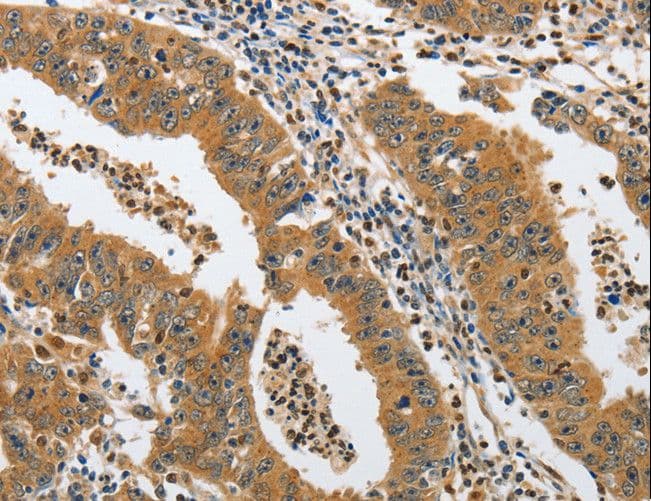 PIK3R3 / p85 Gamma Antibody