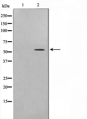 TSAP6 / STEAP3 Antibody (aa26-53)