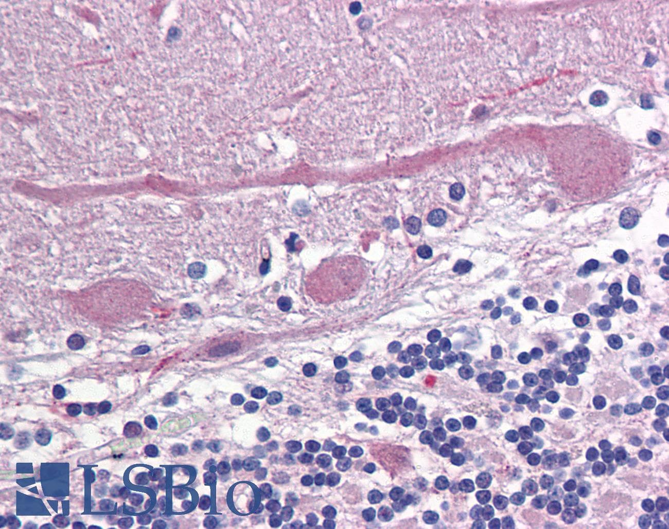 IHC-plus™ Monoclonal Mouse anti-Rat GRIA3 / GLUR3 Antibody (N-Terminus, IHC, IF, WB)