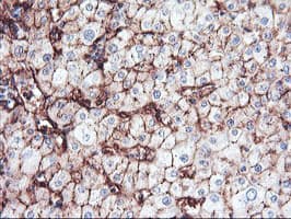 ENPEP / Aminopeptidase A Antibody (clone OTI4G8)
