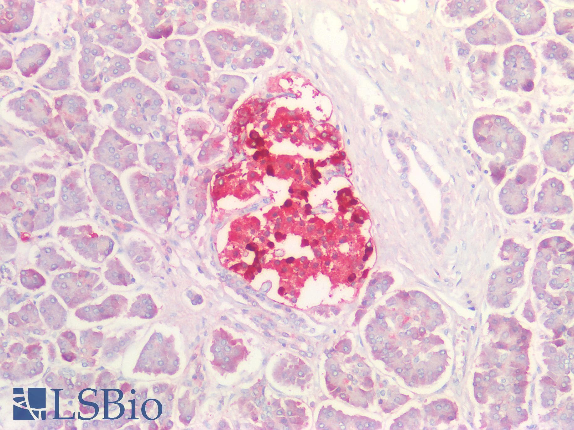 IHC-plus™ TTR / Transthyretin Antibody
