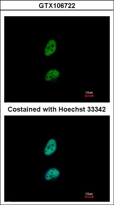 PSME3 Antibody (aa1-254)