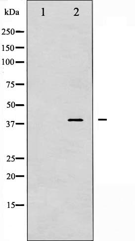 PRKAB1 / AMPK Beta 1 Antibody (phospho-Ser181)