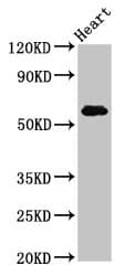 Polyclonal Rabbit anti-Human SLC11A1 / NRAMP Antibody (IHC, WB)