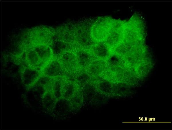 IHC-plus™ MAPK13 / p38delta Antibody (clone 2B2)