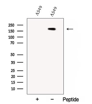 Polyclonal Rabbit anti-Human CC2D2A Antibody (WB)