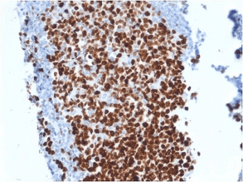 MKI67 / Ki67 Antibody (clone MKI67/2462)