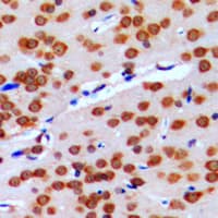 Polyclonal Rabbit anti-Human GPRIN2 / GRIN2 Antibody (N-Terminus, IHC, WB)