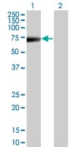 KRT5 / CK5 / Cytokeratin 5 Antibody (clone 1A12)