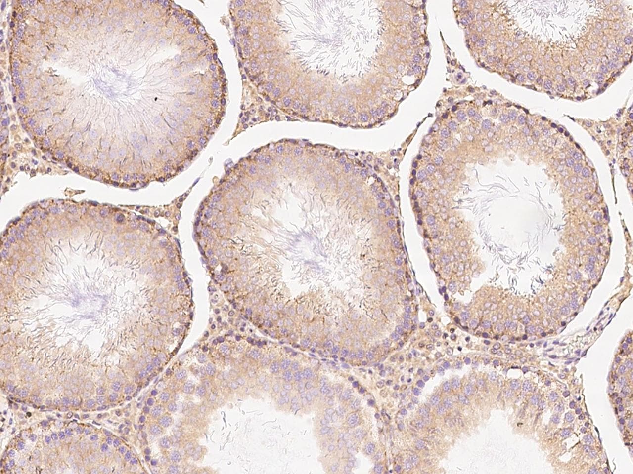 Polyclonal Rabbit anti-Mouse MIA40 / CHCHD4 Antibody (Preservative Free, IHC)