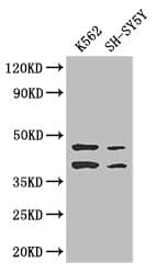 AIM2 Antibody