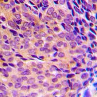 Polyclonal Rabbit anti-Human NFKB1 / NF-Kappa-B Antibody (phospho-Ser337, IHC, WB)