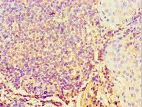 STARD3 / MLN64 Antibody (aa170-445)