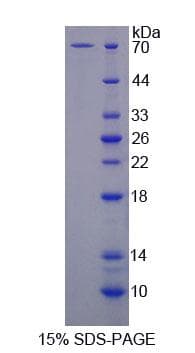 Rat SURF1 Protein (Recombinant His-GST, N-terminus)