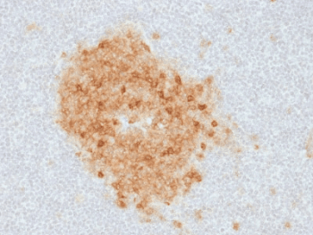 MME / CD10 Antibody (clone MME/1893)