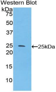 SPRY3 / Sprouty 3 Antibody (aa91-288)