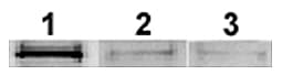 Rat Adiponectin Protein (Recombinant DDK (Flag))