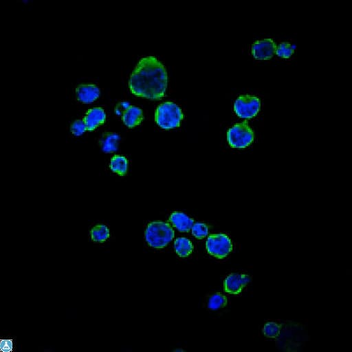 CD1A Antibody