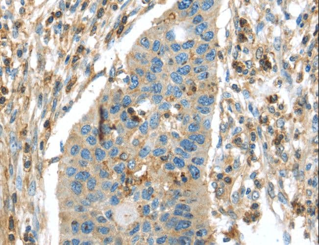 Polyclonal Rabbit anti-Human RIP4 / ANKRD3 Antibody (IHC)