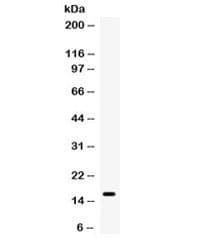 TTR / Transthyretin Antibody