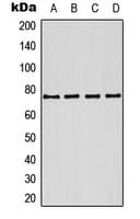 Polyclonal Rabbit anti-Human KCNQ1 / KVLQT1 Antibody (Internal, WB)
